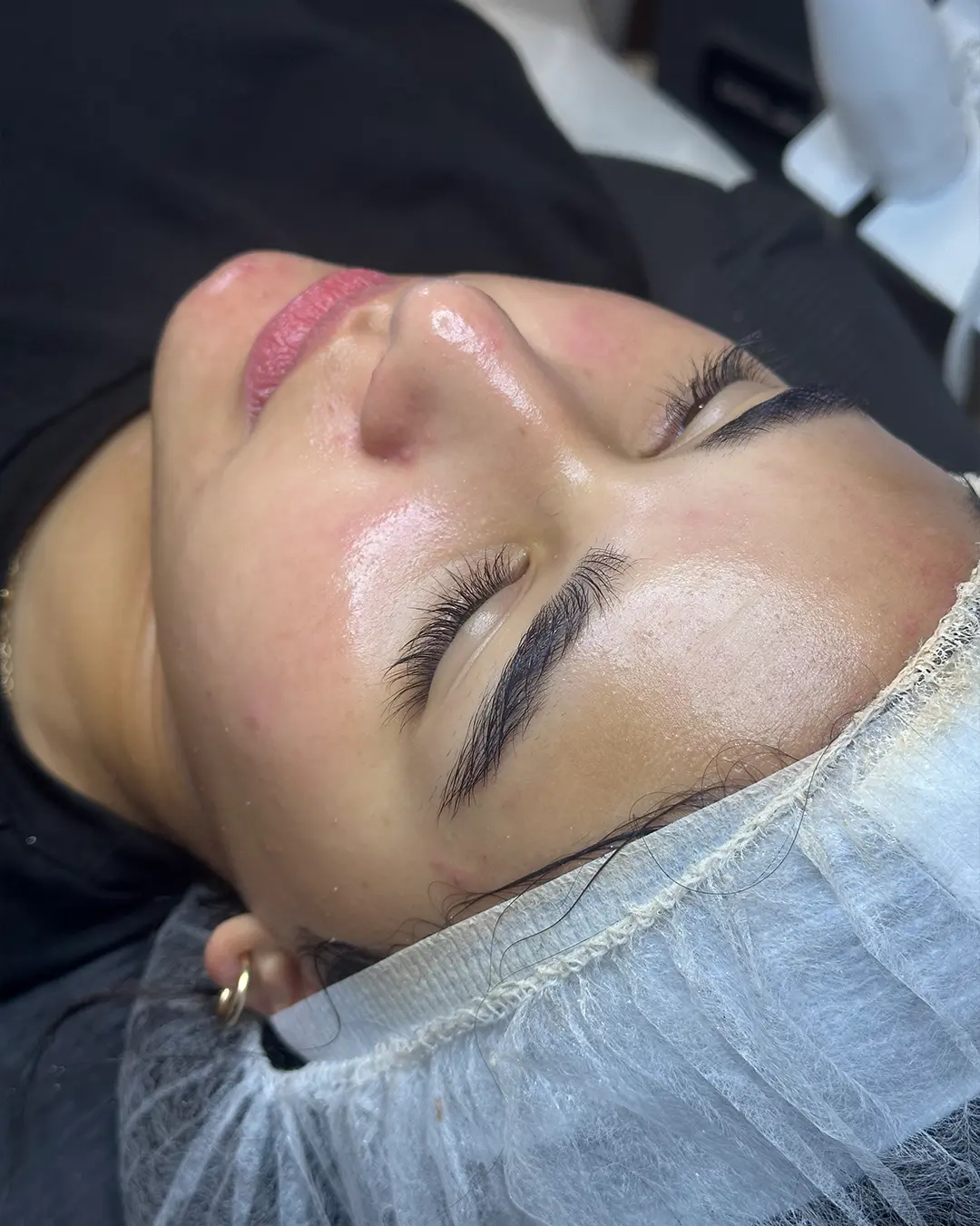 Facial profundo